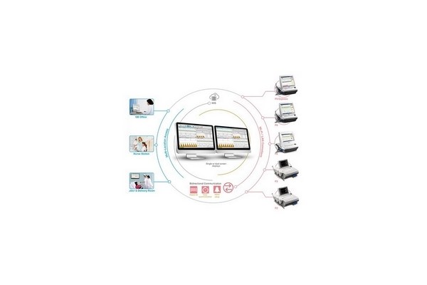 ctg-Centralni nadzor